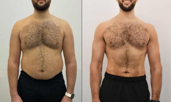 Transformación de Claudio, 36 años, arquitecto