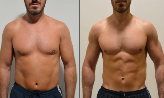 Transformación de Felipe, 41 años, empresario